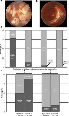 Multimodal Imaging-Based Phenotyping of a Singaporean Hospital-Based Cohort of High Myopia Patients